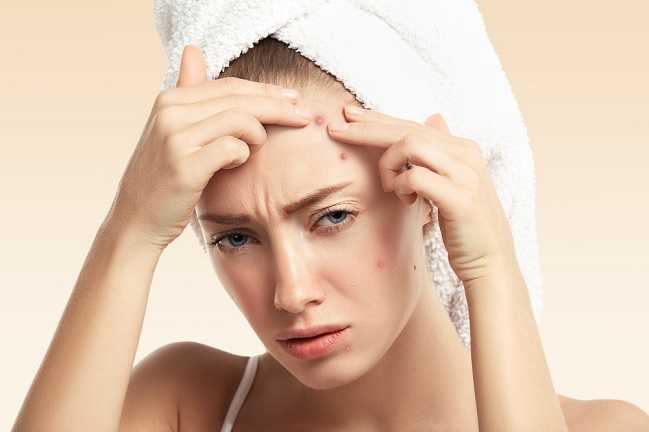 Best Spot Treatment for Acne